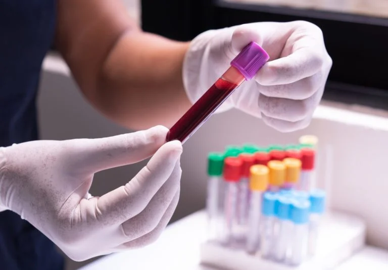 Investigations for Secondary Osteoporosis