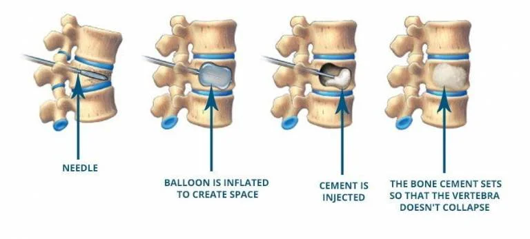 Treatment of the symptomatic patient